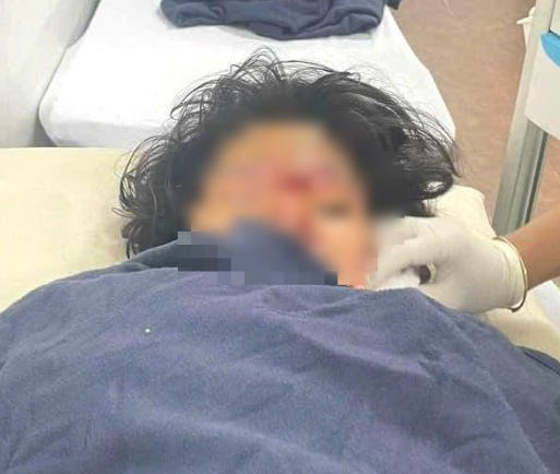 多乐省两起女学生打架事件 教育培训厅协调核实处理